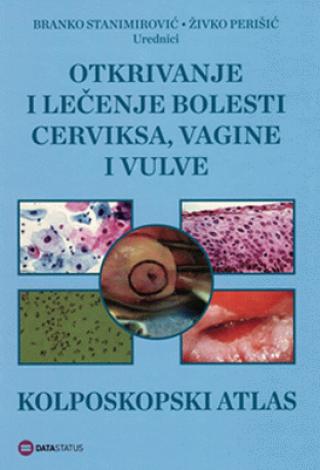 otkrivanje i lečenje bolesti cerviksa, vagine i vulve kolposkopski atlas 