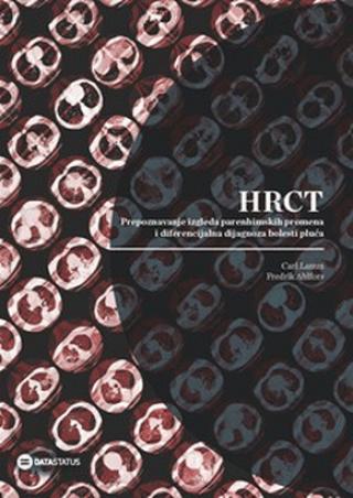 hrct prepoznavanje izgleda parenhimskih promena i diferencijalna dijagnoza bolesti pluća fredrik ahlfors carl lamm 