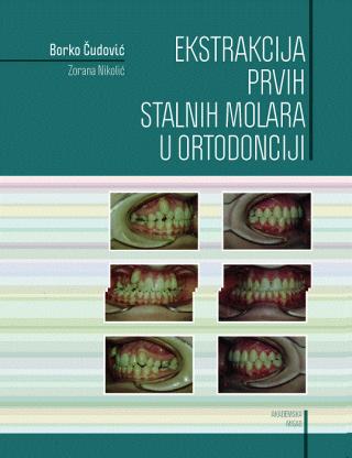 ekstrakcija prvih stalnih molara u ortodonciji borko čudović 